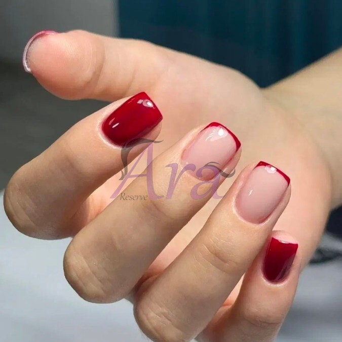 ترمیم با طرح فرنچ