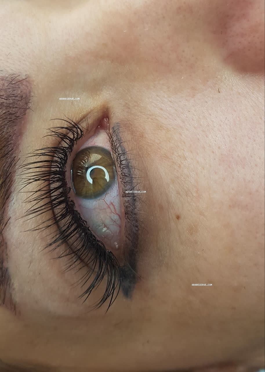 اکستنشن کلاسیک 